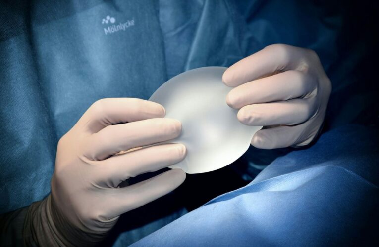 Caso Paloma Nicole: ¿A qué edad se puede hacer una cirugía plástica en México?