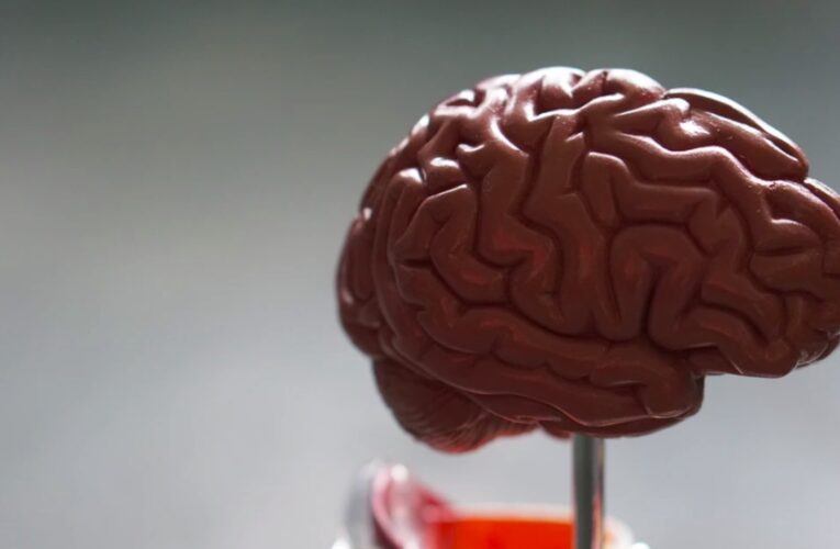 La forma del cerebro podría anticipar la demencia