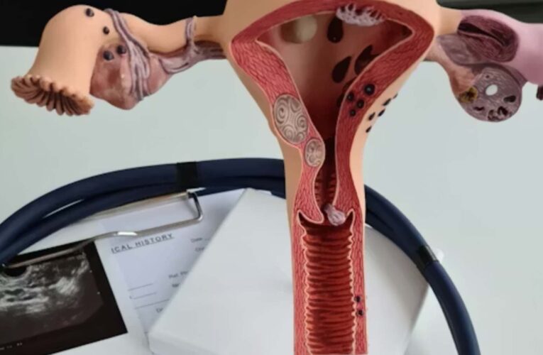 Asociación mexicana pide priorizar la atención del cáncer de ovario