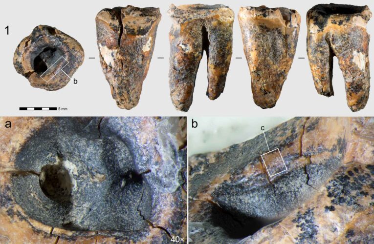 Neandertales trataban caries usando herramientas de piedra hace 60 mil años